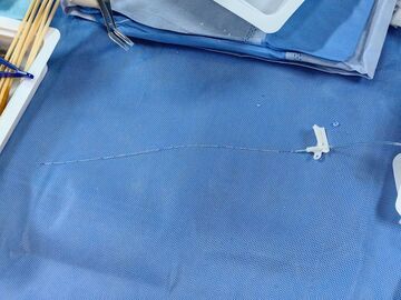 四川省首例！成妇儿为590克超早产儿打通“发丝级”生命通道