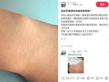 智能手表还能不能放心戴？专家建议