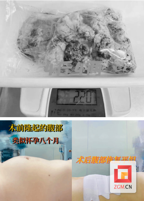 dd00920dd1cf9b1950f8f26a26346624.png