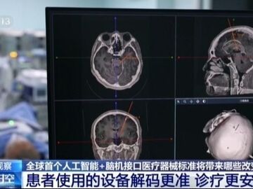 脑机接口再迎新标准 将如何影响你我生活？