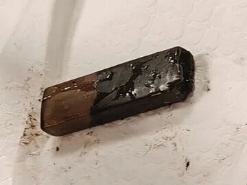 男子7年前误吞打火机，因胃疼就医时才想起，外壳已被严重腐蚀老化，一旦破裂极可能引发胃穿孔等致命急症；医生：误吞异物切勿存侥幸心理